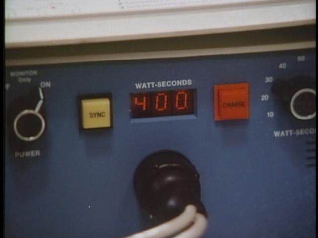 Manual Defibrillator
Displaying at 400 Watt-Seconds (Joules).

Time index: 16:10
Keywords: Lights_Camera_Action